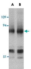 Anti-PRDM1 Rabbit Polyclonal Antibody