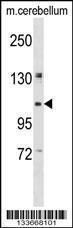 Anti-KIF5B Rabbit Polyclonal Antibody (PE (Phycoerythrin))