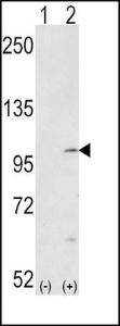 Anti-FGFR Rabbit Polyclonal Antibody (APC (Allophycocyanin))