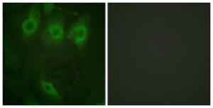 Immunofluorescence analysis of HeLa cells using Anti-EGFR (phospho Tyr1016) Antibody. The right hand panel represents a negative control, where the antibody was pre-incubated with the immunising peptide