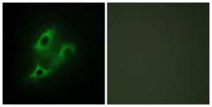 Immunofluorescence analysis of NIH/3T3 cells using Anti-SERC2 Antibody. The right hand panel represents a negative control, where the antibody was pre-incubated with the immunising peptide