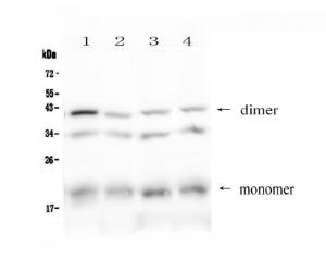 Anti-BAFF Receptor Polyclonal Antibody