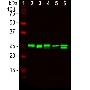 Western blot analysis o