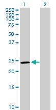 Anti-GSTM5 Rabbit Polyclonal Antibody