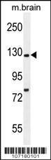 Anti-Kif5C-2 Rabbit Polyclonal Antibody (AP (Alkaline Phosphatase))