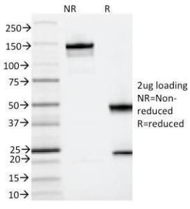 SDS-PAGE analysis of Anti-IL3RA Antibody [IL3RA/2065] under non-reduced and reduced conditions; showing intact IgG and intact heavy and light chains, respectively. SDS-PAGE analysis confirms the integrity and purity of the antibody.