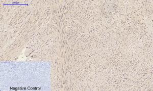 Immunohistochemical analysis of paraffin-embedded human uterus tissue using Anti-CASP1 Antibody at 1:200 (4 °C overnight). Negative control was secondary Antibody only