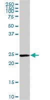 Anti-GSTM5 Rabbit Polyclonal Antibody