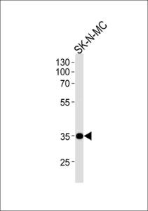 Anti-NKX1-1 Rabbit Polyclonal Antibody (FITC (Fluorescein Isothiocyanate))