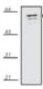 Anti-Heat Shock Protein 65 Mouse Monoclonal Antibody [clone: 4E124]