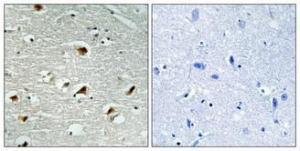 Immunohistochemical analysis of paraffin-embedded human brain using Anti-Abl Antibody 1:100 (4°C overnight). The right hand panel represents a negative control, where the antibody was pre-incubated with the immunising peptide