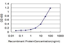 Anti-GSTM5 Mouse Monoclonal Antibody [clone: 1B3]