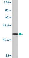 Anti-TK1 Mouse Polyclonal Antibody