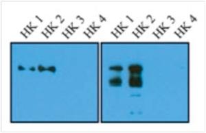 Anti-Hexokinase 1/2 Mouse Monoclonal Antibody [clone: 10D145]