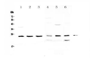 Anti-RAB6A Polyclonal Antibody