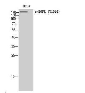 Western blot analysis of HELA cells using Anti-EGFR (phospho Tyr1016) Antibody