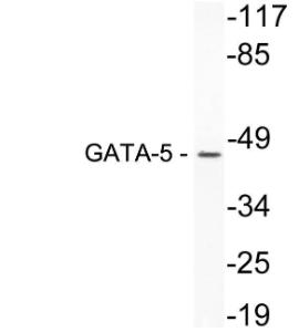 Anti-GATA5 Rabbit Polyclonal Antibody