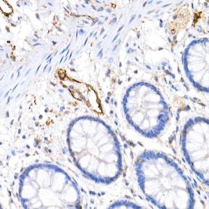 Immunohistochemistry analysis of paraffin-embedded human colon tissue using Anti-Podoplanin / gp36 Antibody (A305444) at a dilution of 1:20 (40x lens). Perform high pressure antigen retrieval with 10 mM citrate buffer pH 6.0 before commencing with IHC staining protocol.