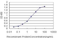 Anti-GSTM5 Mouse Monoclonal Antibody [clone: 1G4]