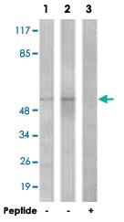 Anti-TGFBR1 Rabbit Polyclonal Antibody