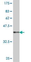 Anti-CLPP Mouse Polyclonal Antibody