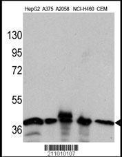 Anti-GAPDH Mouse Monoclonal Antibody [clone: 1A10A10]