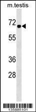 Anti-CBX2 Rabbit Polyclonal Antibody