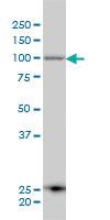 Anti-ERAP1 Mouse Monoclonal Antibody [clone: 4H8]