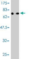 Anti-RUVBL1 Mouse Monoclonal Antibody [clone: 3G4-1F8]