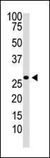 Anti-Dkk-2 Rabbit Polyclonal Antibody (APC (Allophycocyanin))