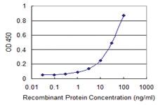 Anti-ERAP1 Mouse Monoclonal Antibody [clone: 4H8]