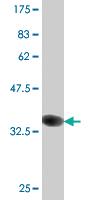 Anti-CLCA1 Mouse Monoclonal Antibody [clone: 1C4]