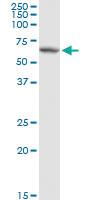 Anti-P4HB Rabbit Polyclonal Antibody