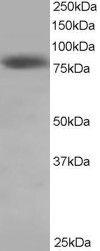 Anti-NDC80 Antibody (A83873) staining (0.5 µg/ml) of Hela lysate (RIPA buffer, 35 µg total protein per lane). Primary incubated for 1 hour. Detected by chemiluminescence