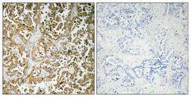 Anti-GATA5 Rabbit Polyclonal Antibody