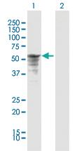 Anti-P4HB Rabbit Polyclonal Antibody