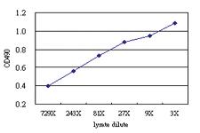 Anti-CCAR2 Antibody Pair