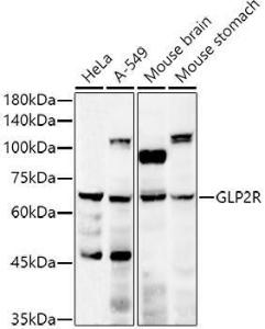 Western blot analysis of extracts of various cell lines, using Anti-GLP2R Antibody (A9933) at 1:500 dilution. The secondary antibody was Goat Anti-Rabbit IgG H&L Antibody (HRP) at 1:10,000 dilution.