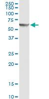 Anti-P4HB Rabbit Polyclonal Antibody