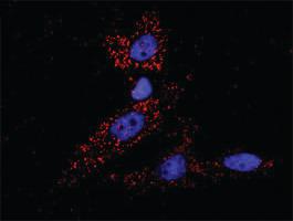 Anti-CDKN1A Antibody Pair