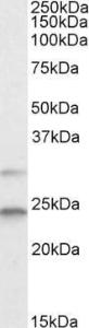 Anti-MAD2L1 Goat Polyclonal Antibody