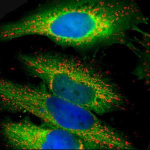 Anti-Heat Shock Protein 27 antibody