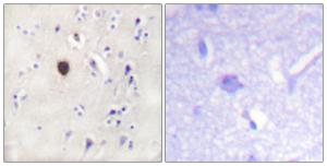 Immunohistochemical analysis of paraffin-embedded human brain tissue using Anti-Kir6.2 Antibody. The right hand panel represents a negative control, where the antibody was pre-incubated with the immunising peptide.