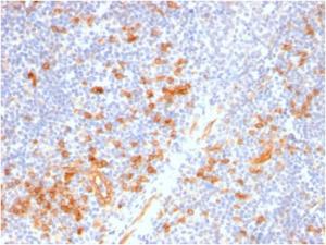 Immunohistochemical analysis of formalin-fixed, paraffin-embedded human tonsil using Anti-IL3RA Antibody [IL3RA/2947R]