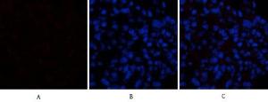 Immunofluorescence analysis of rat lung tissue using Anti-CASP1 Antibody (red) at 1:200 (4 °C overnight). Cy3 labelled secondary Antibody was used at 1:300 (RT 50 min). Panel A: Target. Panel B: DAPI. Panel C: Merge