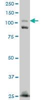 Anti-FNDC3A Mouse Monoclonal Antibody [clone: 2H4]