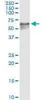 Anti-EFEMP2 Antibody Pair