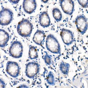 Immunohistochemistry analysis of paraffin-embedded human colon tissue using Anti-GLP2R Antibody (A9933) at a dilution of 1:20 (40x lens). Perform high pressure antigen retrieval with 10 mM citrate buffer pH 6.0 before commencing with IHC staining protocol.