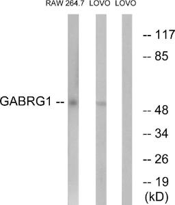 Anti-GABA A Receptor gamma 1 Rabbit Polyclonal Antibody