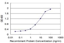 Anti-FAS Mouse Monoclonal Antibody [clone: 3D7]